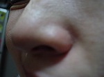 鼻のつけ根の毛穴