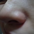 鼻のつけ根の毛穴