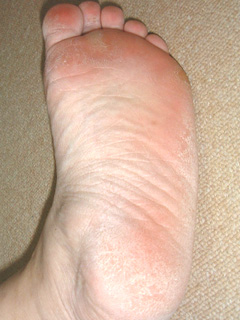babyfootできれいにしたい『汚い足裏』の写真の画像（1枚目）