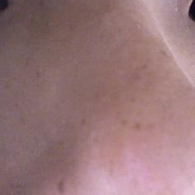 「鼻あたりのくろずみ」モニプラリニューアル記念「毛穴の黒ずみ自慢コンテスト」の投稿画像