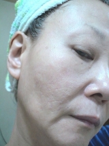 口コミ：★e-Lac Japan★JBS　Placental Mask　体験レポートの画像（15枚目）