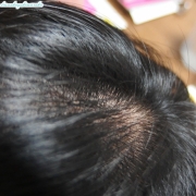 「元気な髪と頭皮になりたいです・・。」夏に傷んだヘアをSY102でケア！写真のテーマ『ダメージヘア』の投稿画像