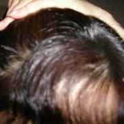 「ぼろぼろ・・・」夏に傷んだヘアをSY102でケア！写真のテーマ『ダメージヘア』の投稿画像