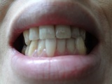 口コミ：薬用パール ホワイト プロ EX で歯を強く、歯を白く！！の画像（12枚目）