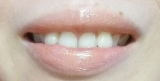 口コミ：結果報告★で、白くなったのか？～歯のホワイトニング　2の画像（4枚目）