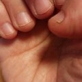 「私の爪」爪が薄い、割れる、でこぼこに！フランス発のネイルエッセンス現品モニター募集の投稿画像