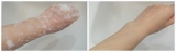 口コミ：プラチナ&ハーブ配合石鹸プリエネージュEXソープの画像（1枚目）