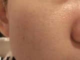 口コミ：おとなの毛穴ケアブランド『アンサージュ』～２ヶ月後のお肌～の画像（12枚目）