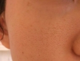 口コミ：おとなの毛穴ケアブランド『アンサージュ』～２ヶ月後のお肌～の画像（10枚目）