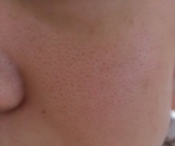 口コミ：おとなの毛穴ケアブランド『アンサージュ』～２ヶ月後のお肌～の画像（7枚目）
