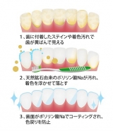 口コミ：ホワイトニング歯磨き体験♪の画像（7枚目）