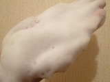 口コミ：大人ニキビを防いでくれる石鹸!!『薬用石鹸ForUzone』を使って1ヶ月。の画像（3枚目）