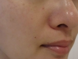 口コミ：炭酸で洗顔！マイクロバブルウォッシュ♪　#炭酸　#洗顔　#MTGの画像（1枚目）