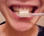口コミ：EM歯みがきの画像（2枚目）