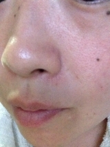 口コミ：ペリカン石鹸 いちご鼻を洗う洗顔石鹸 ドット・ウォッシー②の画像（5枚目）