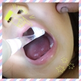 口コミ記事「★子供用音波電動歯ブラシ★」の画像