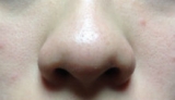 口コミ：(その2）イチゴ鼻はこれで解決！「ドットウォッシー」の画像（6枚目）