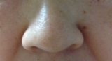 口コミ：(その2）イチゴ鼻はこれで解決！「ドットウォッシー」の画像（2枚目）