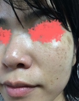 口コミ：石澤研究所さんのお米のマスクはもっちり潤い毛穴効果抜群！ふかふかシートも◎の画像（5枚目）