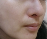 口コミ：身体の中からスッキリ、お肌も綺麗に♡　#カルグルト　#乳酸菌　#腸内フローラ　#スキンケアの画像（1枚目）
