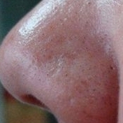 「顔出しＯＫです！ 　」鼻の角栓にお悩みの方限定♪美容オリーブオイルで『いちご鼻ケア』♪の投稿画像