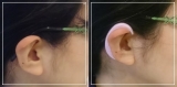 口コミ：肩こり、頭痛、顎関節症？VDT症候群に耳かけリラクゼーションギア earhook #イヤーフックの画像（1枚目）