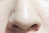 口コミ：いちご鼻に♡洗顔石鹸ドットウォルシーの画像（1枚目）