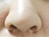 口コミ：いちご鼻に♡洗顔石鹸ドットウォルシーの画像（2枚目）