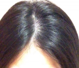 口コミ：髪の綺麗は頭皮から♪オルタニカスカルプエッセンス 2の画像（2枚目）
