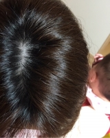 口コミ：産後の抜け毛対策に安心な育毛剤 エンジェルリリアンプラス・モニターの画像（3枚目）