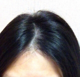 口コミ：髪の綺麗は頭皮から♪オルタニカスカルプエッセンス 3の画像（2枚目）