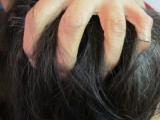口コミ：オールインワン頭皮美容液「オルタニカ スカルプエッセンス」　no.3の画像（1枚目）