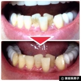 口コミ：【体験終了】人気ホワイトニング歯磨き粉『歯磨撫子』の効果-口コミの画像（2枚目）
