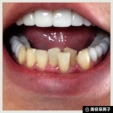 口コミ：【体験終了】人気ホワイトニング歯磨き粉『歯磨撫子』の効果-口コミの画像（3枚目）