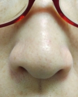 口コミ：いちご鼻専用石鹸パート2の画像（3枚目）