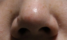 口コミ：いちご鼻を洗う洗顔石鹸～ドット・ウォッシー～②の画像（1枚目）