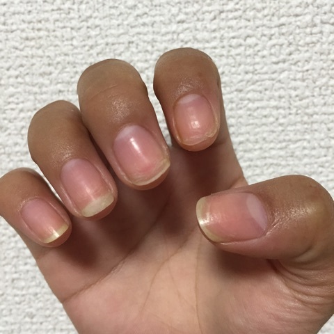 口コミ：使用しました BCネイルセラムAEDの画像（7枚目）