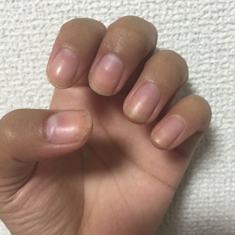 口コミ：使用しました BCネイルセラムAEDの画像（9枚目）