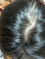 口コミ記事「女性のための頭皮用美容液ナノインパクト100レディ現品モニター体験」の画像