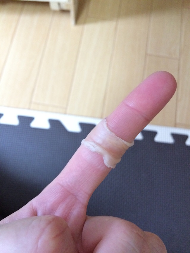 口コミ：キズクイック 指用サイズを試してみました！の画像（11枚目）