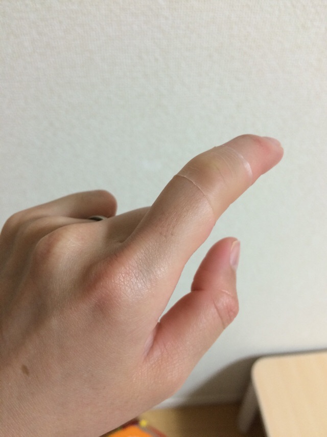 口コミ：キズクイック 指用サイズを試してみました！の画像（9枚目）
