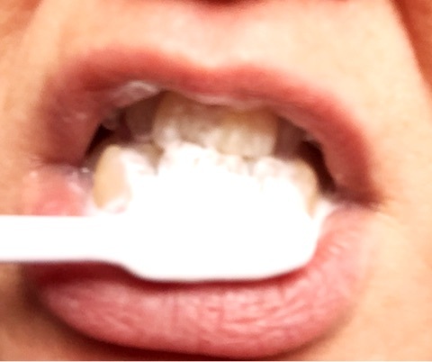 口コミ：薬用なたまめ柿渋歯磨きで口臭、歯周病予防していますの画像（5枚目）