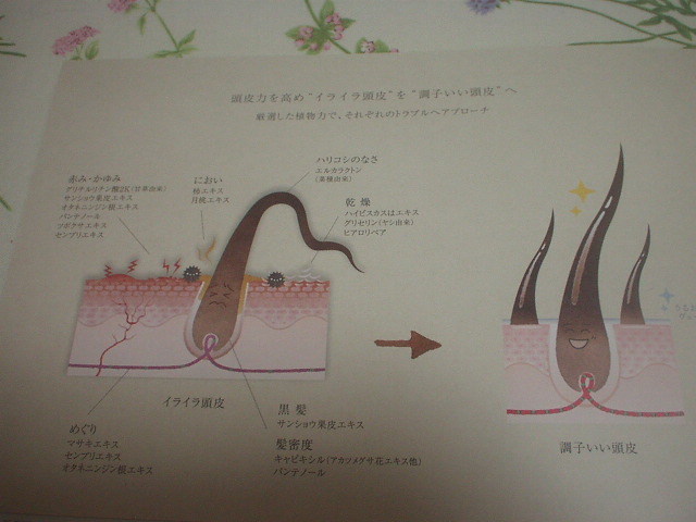 口コミ：オルタニカ　スカルプエッセンス をお試しです。の画像（6枚目）