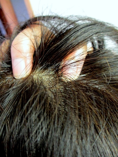 口コミ：気になる抜け毛やコシ不足に　シャルエーゼ 頭皮エッセンスの画像（6枚目）