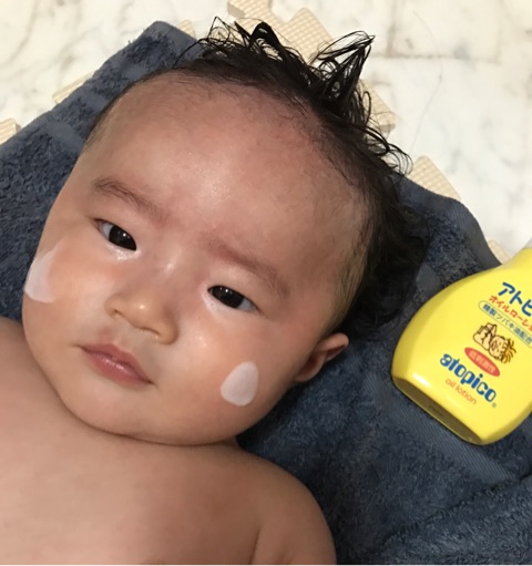 口コミ：『アトピコ』ツバキ油で赤ちゃん肌の乾燥対策！の画像（4枚目）