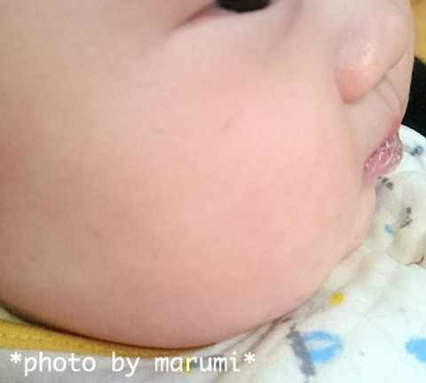 口コミ：皮膚科学のスキンケア！赤ちゃんの敏感肌にも使えるベビーマトリックスF（保湿美容液）の画像（7枚目）