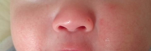口コミ：皮膚科学のスキンケア！赤ちゃんの敏感肌にも使えるベビーマトリックスF（保湿美容液）の画像（6枚目）