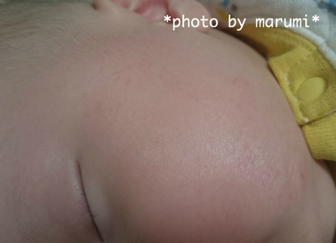口コミ：皮膚科学のスキンケア！赤ちゃんの敏感肌にも使えるベビーマトリックスF（保湿美容液）の画像（5枚目）