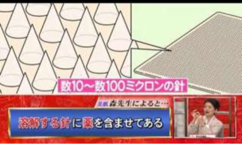 口コミ：ここまで来たか最新医療！自宅でヒアルロン酸注入ができる⁇クオニス☆ダーマフィーラーの画像（3枚目）