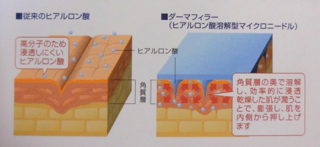 口コミ：
  ヒアルロン酸でできたミクロの針で直接潤いを届けるパック
の画像（2枚目）